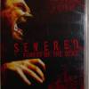 Severed  |  Ungeschnittene Fas...