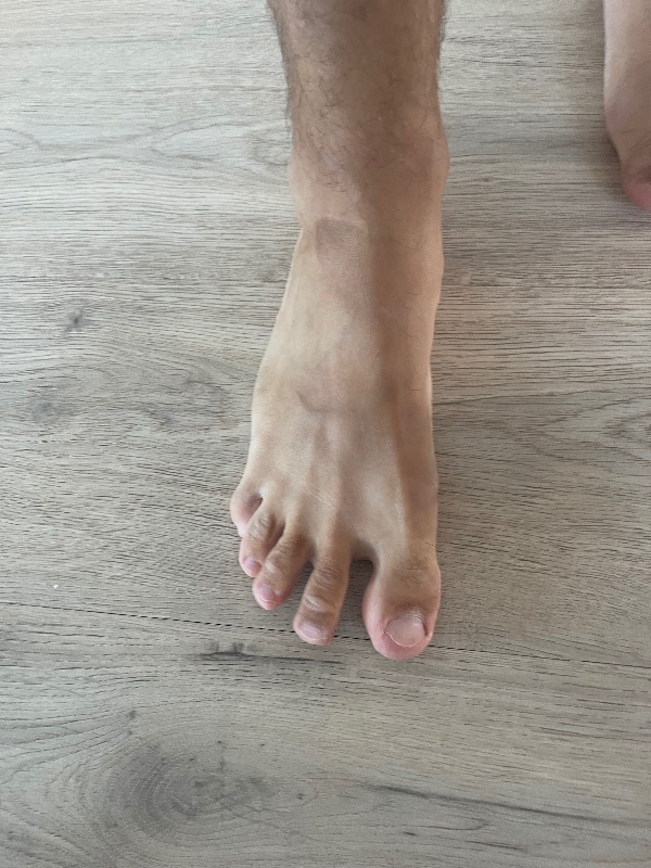 F��e und socken